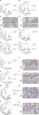 PARP2 downregulation in T cells ameliorates lipopolysaccharide-induced inflammation of the large intestine